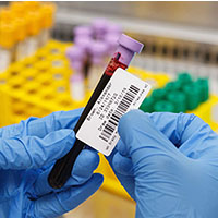 A person applies a barcode label to a test tube.
