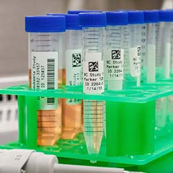 Vials with QR code labels.