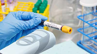 A chemist scans a barcode on a vial.